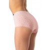 FIGI KEY LPM-731 B25 /XL